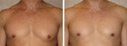 Before & After Photos